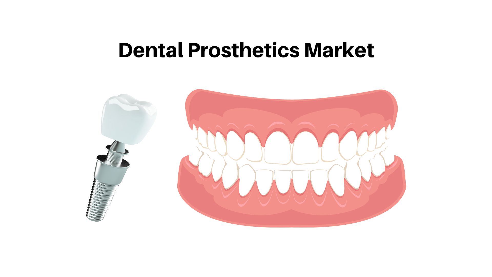 Global Dental Prosthetics Market Will Hit USD 2453 Mn by 2032 with a CAGR of 13.3%
