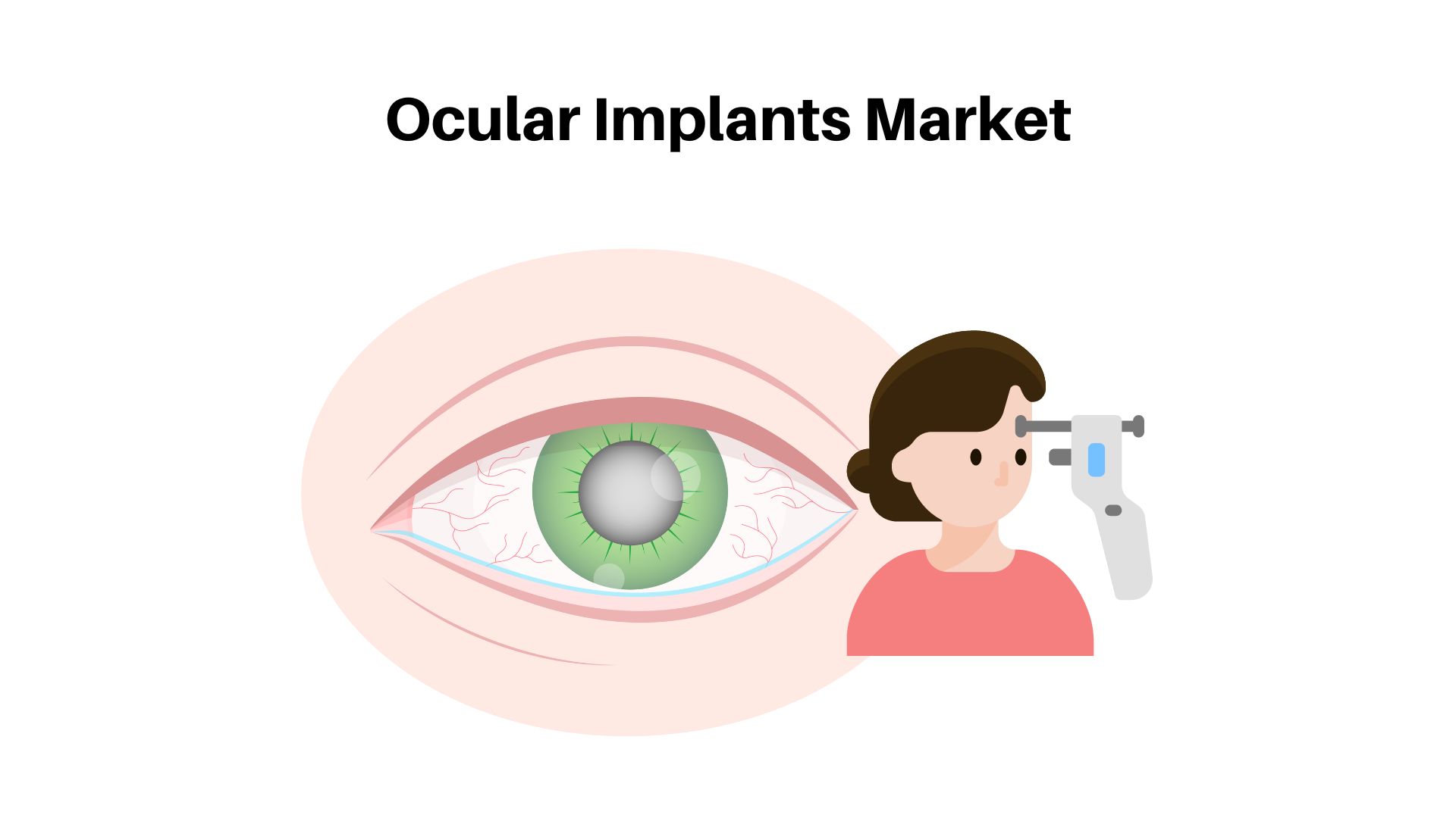 Ocular Implants Market Size USD 24.3 Billion | Annual Growth Rate of 5.8% by 2032