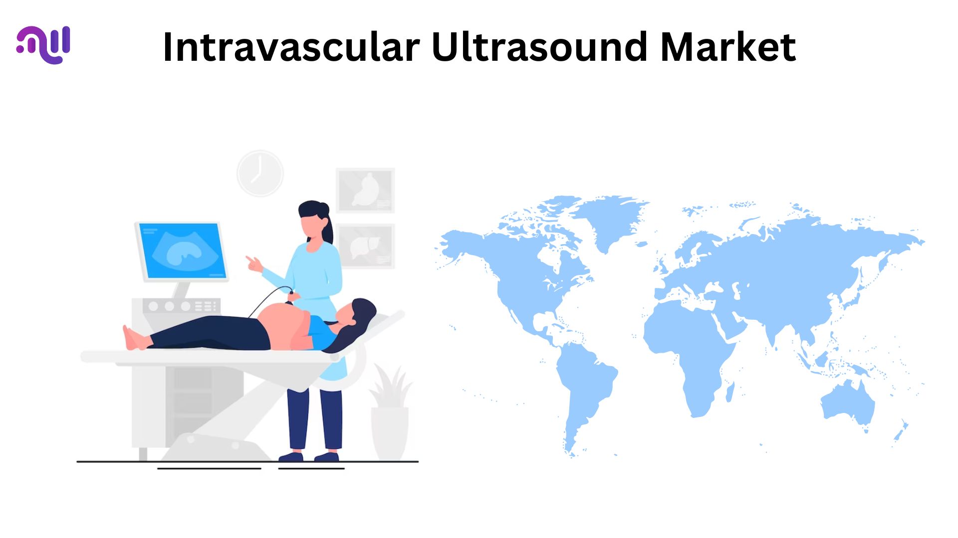 Intravascular Ultrasound Market Size Will Reach USD 1,296 Million By 2033: Market.us